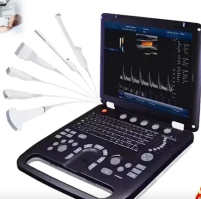 Ultrasound Machine 3D Echo Doppler