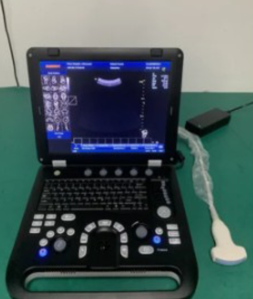 Ultrasound Machine 3D Echo Doppler